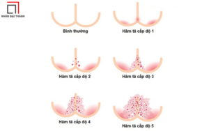 Tã bệnh nhân